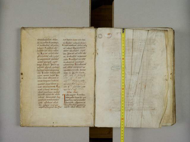 Alexandre de Tralles. « Incipit liber primus Alexandri de medicina. De alopicia et ophyasi. Contigit hec duplex passio... »